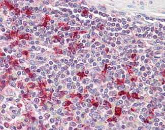IHC - PTMA Antibody (C-Terminus) ALS14955
