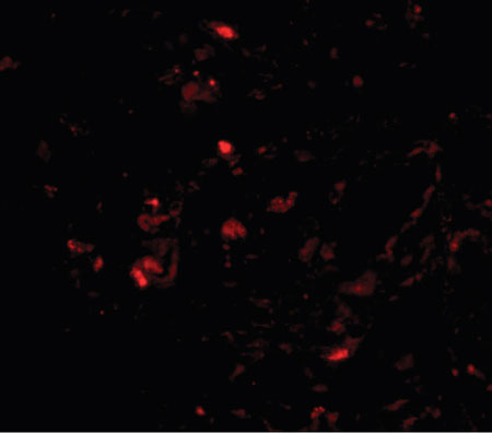 IF - TTR / Transthyretin Antibody (Internal) ALS15165