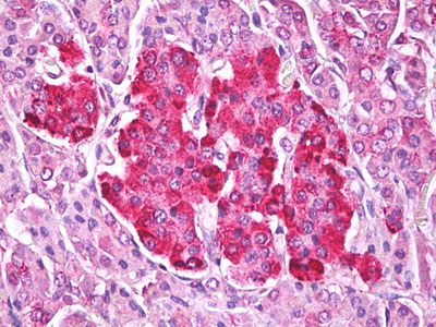 IHC - TTR / Transthyretin Antibody (Internal) ALS15165