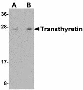 WB - TTR / Transthyretin Antibody (Internal) ALS15165