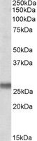 WB - SNAP23 / SNAP-23 Antibody (Internal) ALS15384