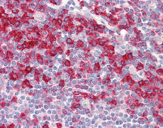 IHC - D52 / TPD52 Antibody (aa41-90) ALS15440