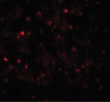 IF - TCTEX1D4 Antibody (N-Terminus) ALS15614