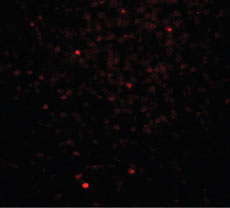 IF - CLEC7A / Dectin 1 Antibody (Internal) ALS15621