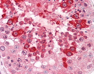 IHC - CLEC7A / Dectin 1 Antibody (Internal) ALS15621