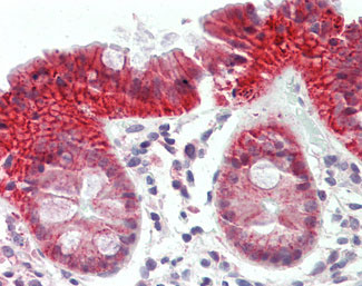 IHC - ATG2B Antibody (N-Terminus) ALS15651