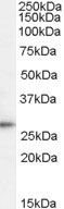 WB - D52 / TPD52 Antibody (C-Terminus) ALS15777