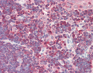 IHC - CDK5RAP3 Antibody (aa341-390) ALS15983