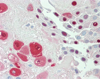 IHC - SERPINB2 / PAI-2 Antibody (clone 1G3) ALS16272