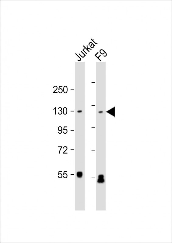 All lanes : Anti-SIRT1 Antibody at 1:1000 dilutionLane 1: Jurkat whole cell lysateLane 2: F9 whole cell lysateLysates/proteins at 20 �g per lane. SecondaryGoat Anti-mouse IgG,  (H+L), Peroxidase conjugated at 1/10000 dilution. Predicted band size : 82 kDaBlocking/Dilution buffer: 5% NFDM/TBST.