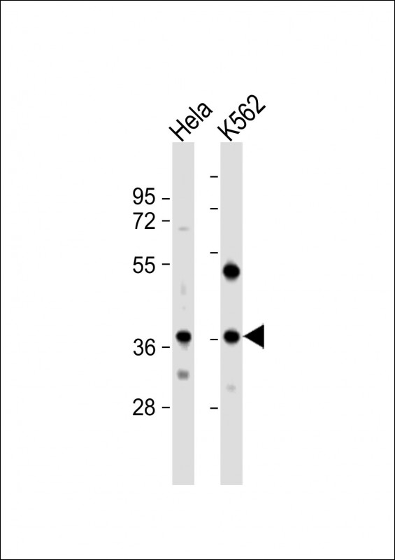WB - CTDSPL Antibody (N-term) AP10036a