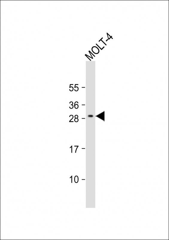WB - ALKBH6 Antibody (Center) AP11283c