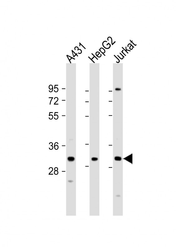 WB - LY6G6F Antibody (N-term) AP16806A