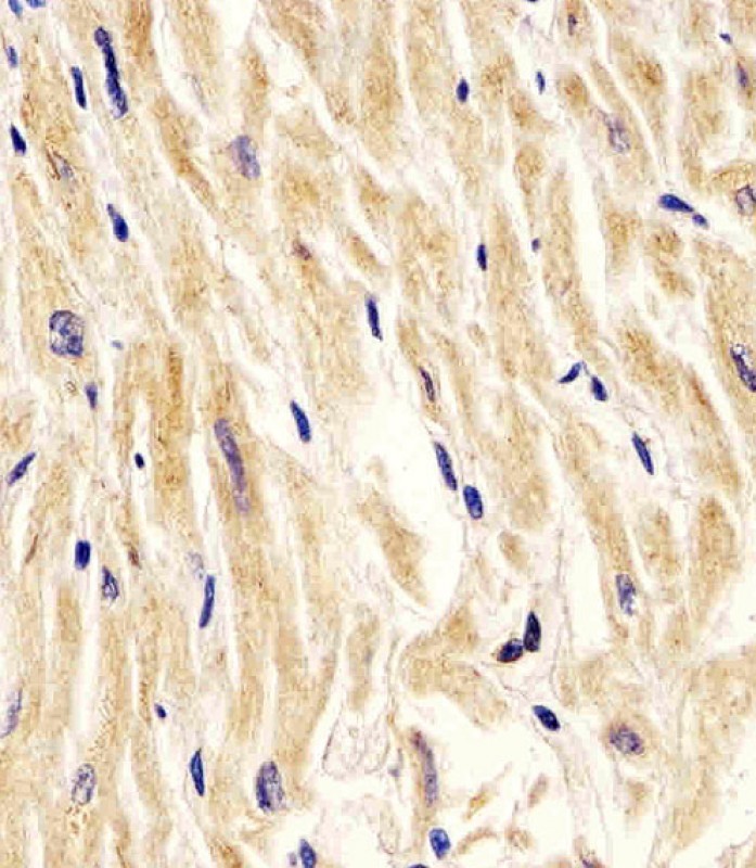 IHC-P - Cleaved LC3A Antibody AP1805a