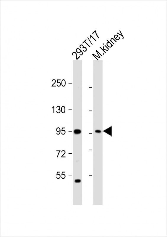 WB - LRRC8A Antibody(C-term) AP19519b