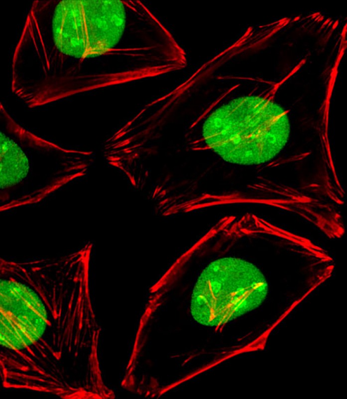 Immunofluorescent analysis of 4% paraformaldehyde-fixed,  0. 1% Triton X-100 permeabilized Hela (Human Cervical epithelial adenocarcinoma cell line) cells labeling EWSR1 with AP20984c at 1/25 dilution,  followed by Alexa Fluor 488-conjugated goat anti-rabbit IgG (1583138) secondary antibody at 1/400 dilution (green).  Confocal image showing nuclear staining on Hela cell line.  Cytoplasmic actin is detected with Alexa Fluor� 555 conjugated with Phalloidin (OB16636430) at 1/100 dilution (red).