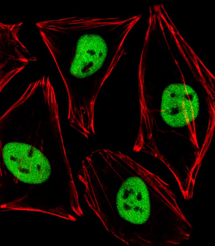 Immunofluorescent analysis of 4% paraformaldehyde-fixed,  0. 1% Triton X-100 permeabilized Hela (Human Cervical epithelial adenocarcinoma cell line) cells labeling Pdx1 with AP21086a at 1/25 dilution,  followed by Alexa Fluor 488-conjugated goat anti-rabbit IgG (1583138) secondary antibody at 1/400 dilution (green).  Confocal image showing nuclear staining on Hela cell line.  Cytoplasmic actin is detected with Alexa Fluor� 555 conjugated with Phalloidin (OB16636430) at 1/100 dilution (red).