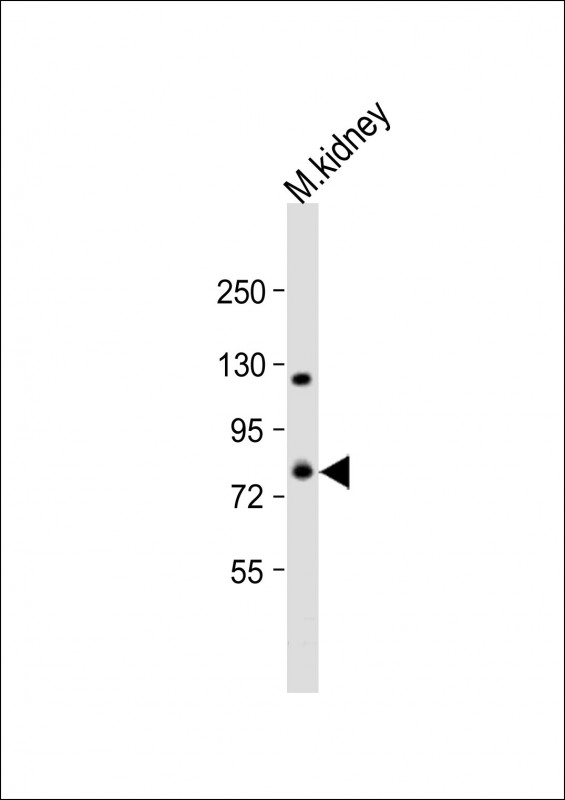 WB - ADAM21 Antibody (C-term) AP21757b