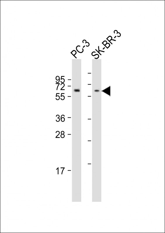 All lanes : Anti-KAT5 Antibody (C-Term) at 1:2000 dilutionLane 1: PC-3 whole cell lysateLane 2: SK-BR-3 whole cell lysateLysates/proteins at 20 �g per lane. SecondaryGoat Anti-Rabbit IgG,  (H+L), Peroxidase conjugated at 1/10000 dilution. Predicted band size : 59 kDaBlocking/Dilution buffer: 5% NFDM/TBST.