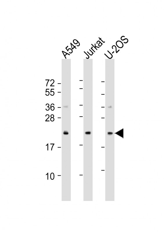 WB - FAAP24 Antibody (N-Term) AP21766a
