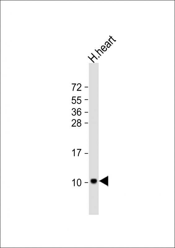 Anti-ATP5EP2 Antibody (Center) at 1:2000 dilution + human heart lysateLysates/proteins at 20 �g per lane. SecondaryGoat Anti-Rabbit IgG,  (H+L), Peroxidase conjugated at 1/10000 dilution. Predicted band size : 6 kDaBlocking/Dilution buffer: 5% NFDM/TBST.