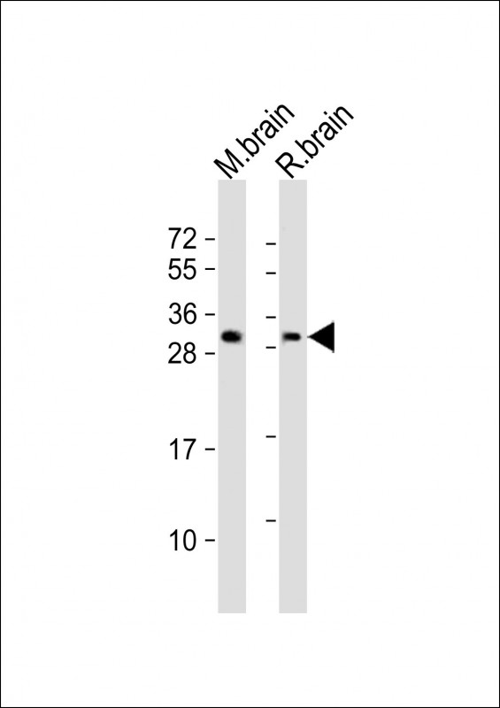 All lanes : Anti-PPP1R1B Antibody (N-Term) at 1:2000 dilutionLane 1: mouse brain lysateLane 2: rat brain lysateLysates/proteins at 20 �g per lane. SecondaryGoat Anti-Rabbit IgG,  (H+L), Peroxidase conjugated at 1/10000 dilution. Predicted band size : 23 kDaBlocking/Dilution buffer: 5% NFDM/TBST.