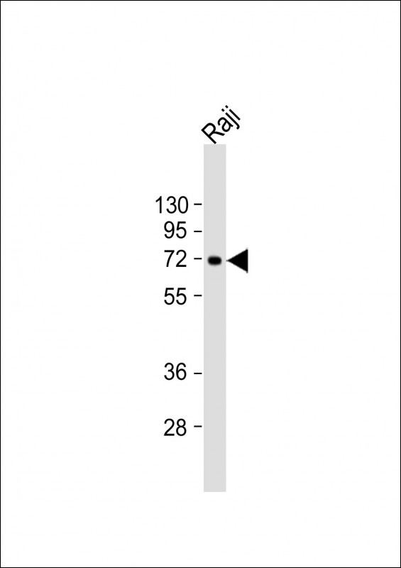 WB - ZBTB7C Antibody (Center) AP21799c