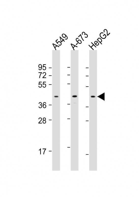 All lanes : Anti-CSNK2A3 Antibody (C-Term) at 1:1000 dilutionLane 1: A549 whole cell lysateLane 2: A-673 whole cell lysateLane 3: HepG2 whole cell lysateLysates/proteins at 20 �g per lane. SecondaryGoat Anti-Rabbit IgG,  (H+L), Peroxidase conjugated at 1/10000 dilution. Predicted band size : 45 kDaBlocking/Dilution buffer: 5% NFDM/TBST.