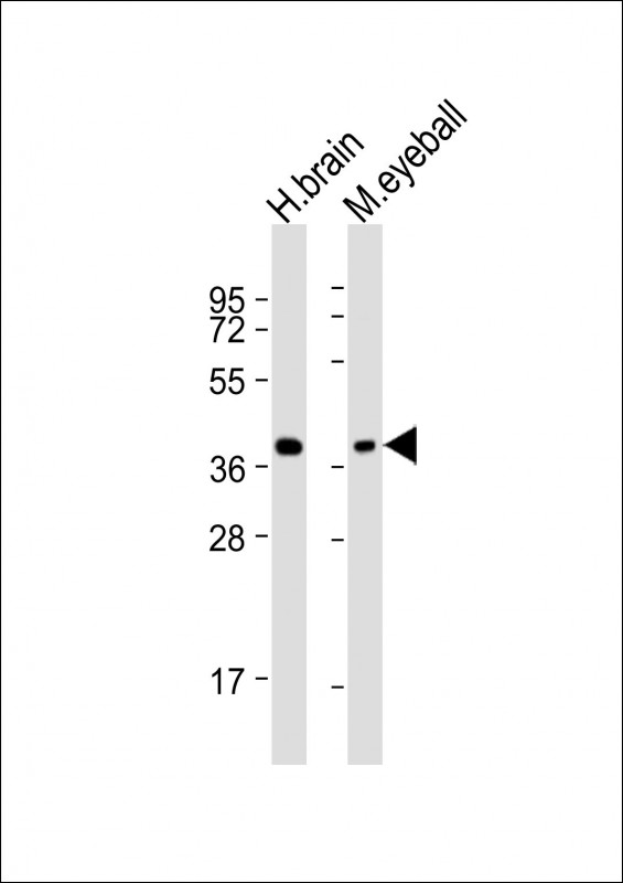 All lanes : Anti-ARR3 Antibody (N-Term) at 1:2000 dilutionLane 1: human brain lysateLane 2: mouse eyeball lysateLysates/proteins at 20 �g per lane. SecondaryGoat Anti-Rabbit IgG,  (H+L), Peroxidase conjugated at 1/10000 dilution. Predicted band size : 43 kDaBlocking/Dilution buffer: 5% NFDM/TBST.