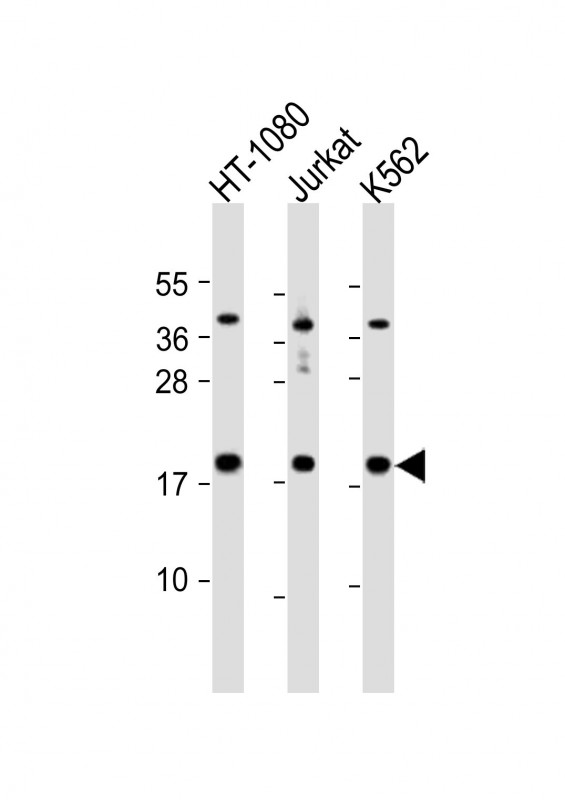WB - NAT13 Antibody (C-term) AP5060b