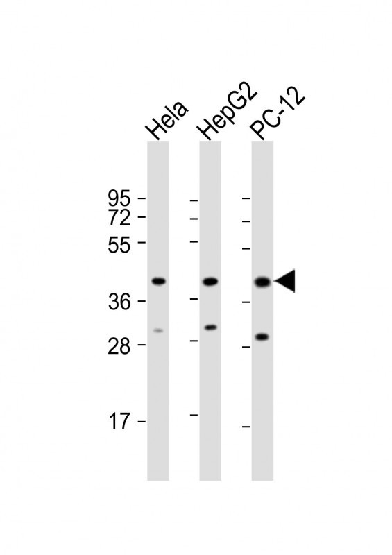 All lanes : Anti-MAPK14 Antibody (Y323) at 1:2000 dilutionLane 1: Hela whole cell lysateLane 2: HepG2 whole cell lysateLane 3: PC-12 whole cell lysateLysates/proteins at 20 �g per lane. SecondaryGoat Anti-Rabbit IgG,  (H+L), Peroxidase conjugated at 1/10000 dilution. Predicted band size : 41 kDaBlocking/Dilution buffer: 5% NFDM/TBST.