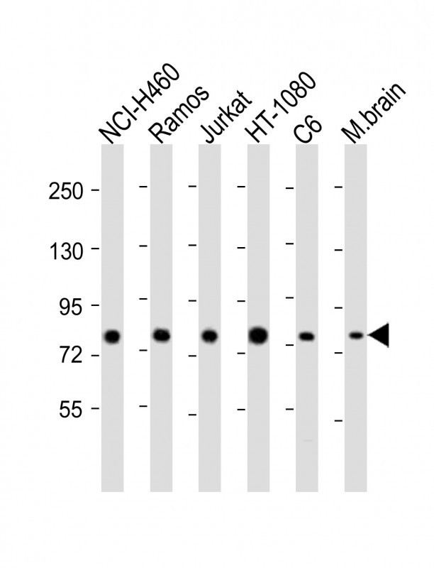 All lanes : Anti-GARS Antibody (C-term) at 1:2000 dilutionLane 1: NCI-H460 whole cell lysateLane 2: Ramos whole cell lysateLane 3: Jurkat whole cell lysateLane 4: HT-1080 whole cell lysateLane 5: C6 whole cell lysateLane 6: mouse brain lysateLysates/proteins at 20 �g per lane. SecondaryGoat Anti-Rabbit IgG,  (H+L), Peroxidase conjugated at 1/10000 dilution. Predicted band size : 83 kDaBlocking/Dilution buffer: 5% NFDM/TBST.