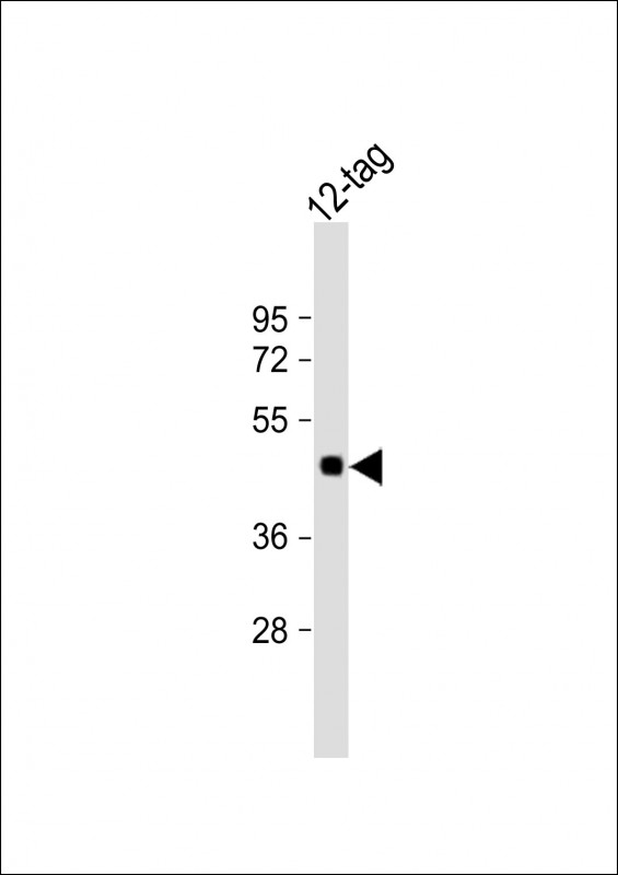 Anti-Myc Tag Antibody at 1:2000 dilution + 12-tag protein lysateLysates/proteins at 20 �g per lane. Predicted band size : 45 kDaBlocking/Dilution buffer: 5% NFDM/TBST.