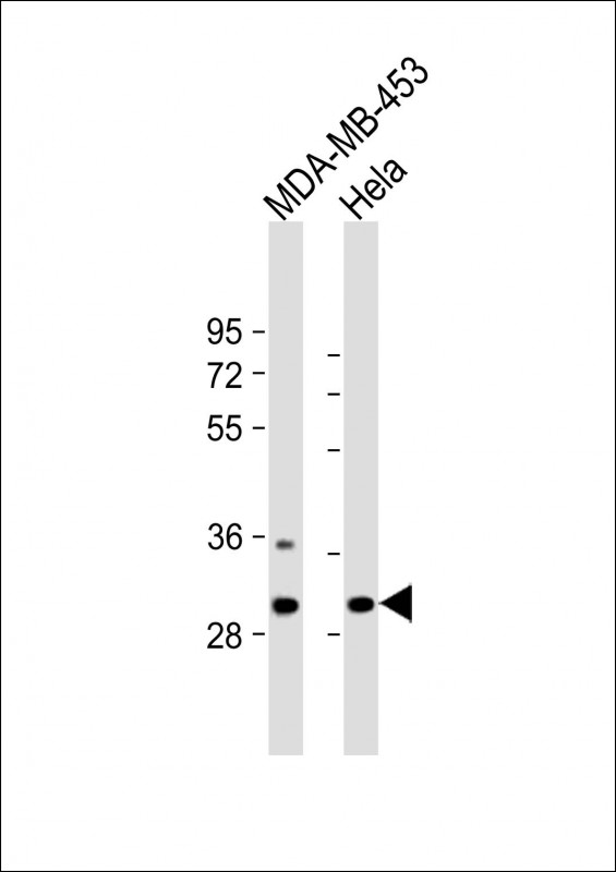 All lanes : Anti-BPGM Antibody (C-term) at 1:2000 dilutionLane 1: MDA-MB-453 whole cell lysateLane 2: Hela whole cell lysateLysates/proteins at 20 �g per lane. SecondaryGoat Anti-Rabbit IgG,  (H+L), Peroxidase conjugated at 1/10000 dilution. Predicted band size : 30 kDaBlocking/Dilution buffer: 5% NFDM/TBST.