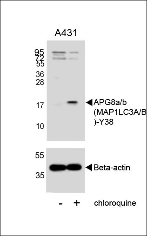 WB - LC3 Antibody (APG8A/B) AP1803a