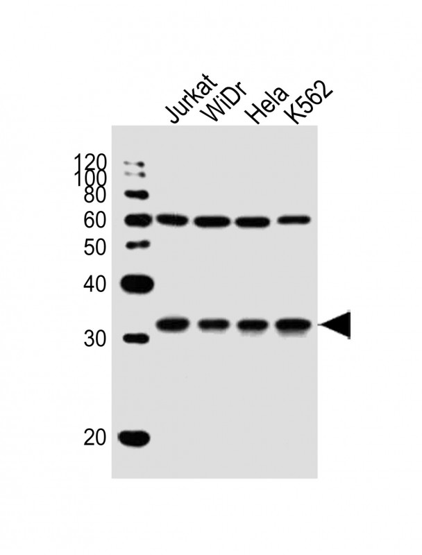 All lanes : Anti-EXOSC6 Antibody (N-term) at 1:1000 dilutionLane 1: Jurkat whole cell lysateLane 2: WiDr whole cell lysateLane 3: Hela whole cell lysateLane 4: K562 whole cell lysateLysates/proteins at 20 �g per lane. SecondaryGoat Anti-Rabbit IgG,  (H+L), Peroxidase conjugated at 1/10000 dilution. Predicted band size : 28 kDaBlocking/Dilution buffer: 5% NFDM/TBST.