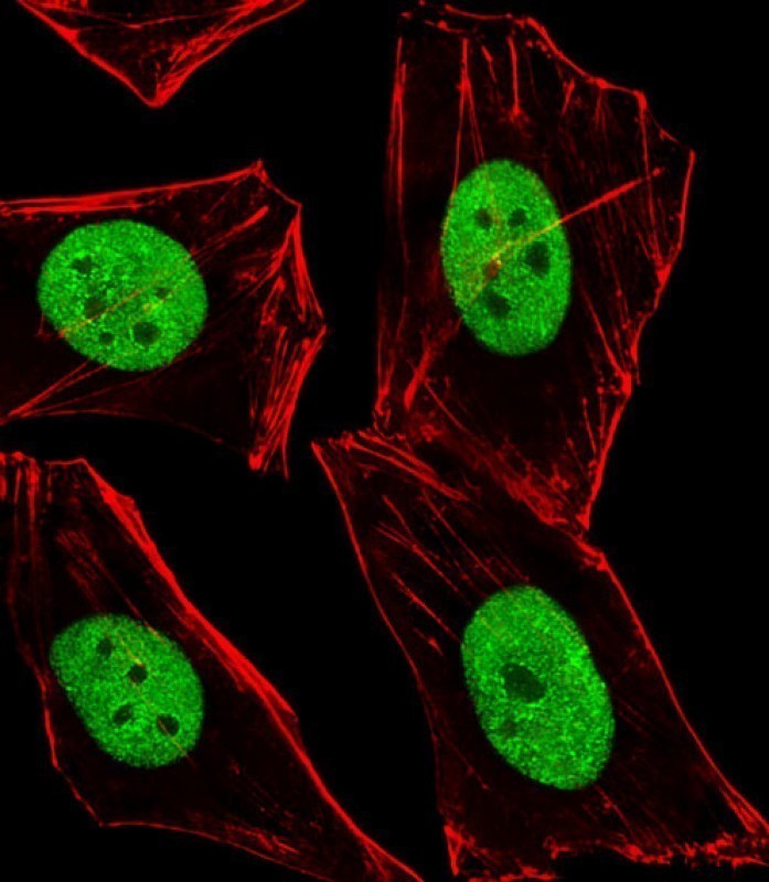 Immunofluorescent analysis of 4% paraformaldehyde-fixed, 0.1% Triton X-100 permeabilized Hela (Human cervical epithelial adenocarcinoma cell line) cells labeling BMI1 with AP21642b at 1/25 dilution, followed by Alexa Fluor 488-conjugated goat anti-rabbit IgG (1583138) secondary antibody at 1/400 dilution (green).     Confocal image showing nuclear staining on Hela cell line.     Cytoplasmic actin is detected with Alexa Fluor� 555 conjugated with Phalloidin (OB16636430) at 1/100 dilution (red).