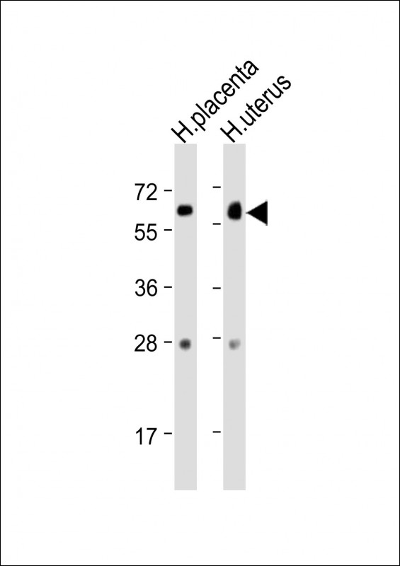 WB - ZBTB7C Antibody (N-Term) AP21825a