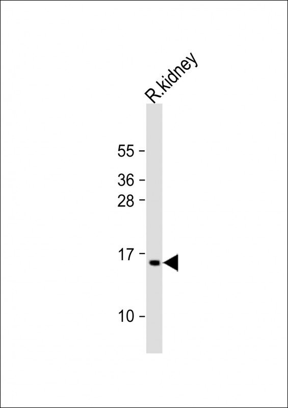 Anti-ATP5G3 Antibody (N-Term) at 1:2000 dilution + rat kidney lysateLysates/proteins at 20 �g per lane. SecondaryGoat Anti-Rabbit IgG,  (H+L), Peroxidase conjugated at 1/10000 dilution. Predicted band size : 15 kDaBlocking/Dilution buffer: 5% NFDM/TBST.