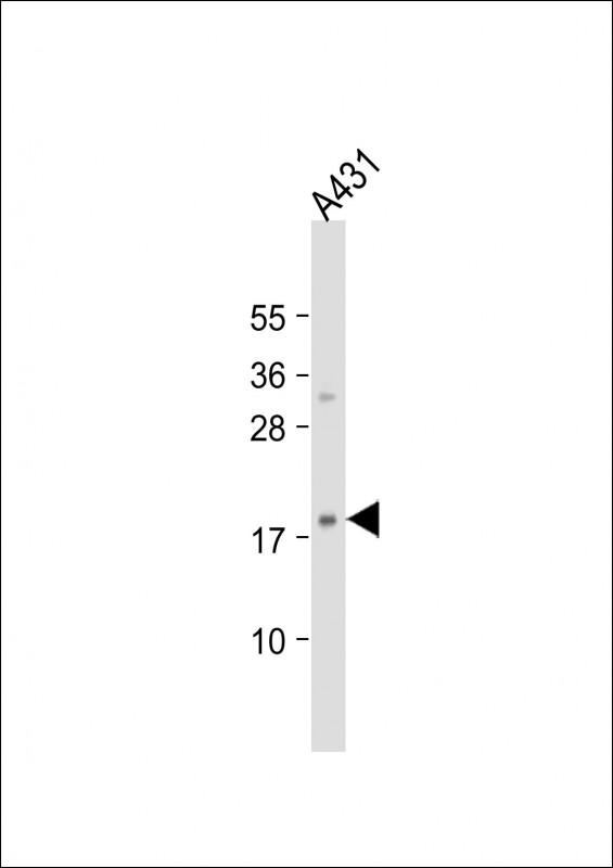 Anti-H3f3b Antibody (Center) at 1:2000 dilution + A431 whole cell lysateLysates/proteins at 20 �g per lane. SecondaryGoat Anti-Rabbit IgG,  (H+L), Peroxidase conjugated at 1/10000 dilution. Predicted band size : 15 kDaBlocking/Dilution buffer: 5% NFDM/TBST.