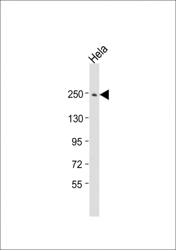 Anti-APC2 Antibody (N-Term) at 1:2000 dilution + Hela whole cell lysateLysates/proteins at 20 �g per lane. SecondaryGoat Anti-Rabbit IgG,  (H+L), Peroxidase conjugated at 1/10000 dilution. Predicted band size : 244 kDaBlocking/Dilution buffer: 5% NFDM/TBST.