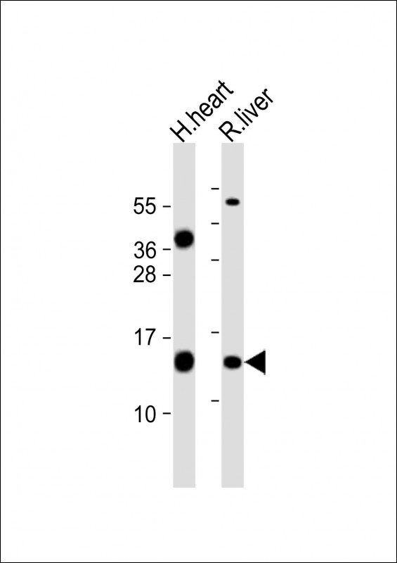 WB - FXC1 Antibody (N-term) AP21868a