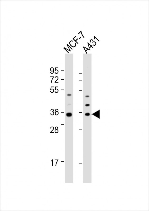 WB - Cyclin D1 Antibody (S90) AP2612d