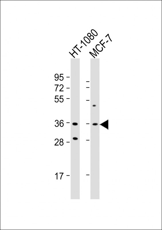 WB - Cyclin D1 Antibody (S90) AP2612d