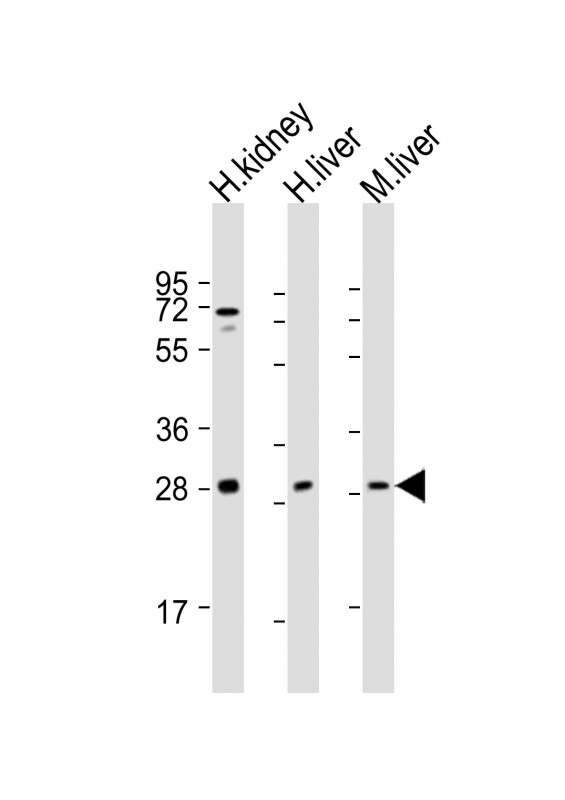 All lanes : Anti-SIRT3 Antibody (C-term) at 1:2000 dilutionLane 1: human kidney lysateLane 2: human liver lysateLane 3: mouse liver lysateLysates/proteins at 20 �g per lane. SecondaryGoat Anti-Rabbit IgG,  (H+L), Peroxidase conjugated at 1/10000 dilution. Predicted band size : 44 kDaBlocking/Dilution buffer: 5% NFDM/TBST.