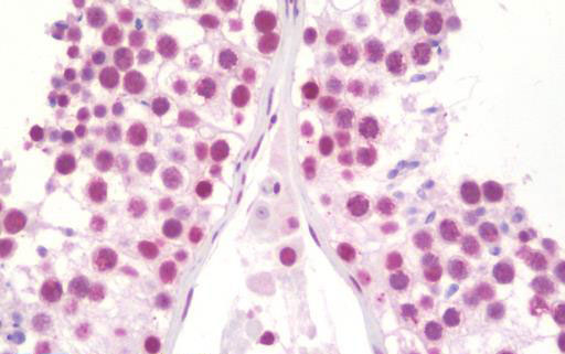 IHC - Lysyl Oxidase / LOX Antibody (clone 9A11) ALS16732
