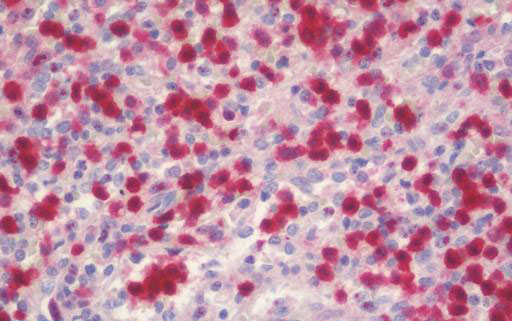 IHC - PGD Antibody (clone 2A5) ALS16843