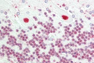 IHC - NCL / Nucleolin Antibody (clone 4E2) ALS16979