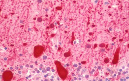 IHC - PVALB / Parvalbumin Antibody (aa51-100) ALS16992