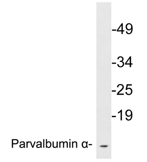 WB - PVALB / Parvalbumin Antibody (aa51-100) ALS16992